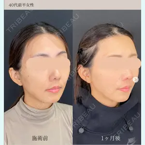 自由が丘ウェルエイジングビューティークリニックの症例