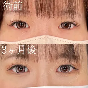 HAAB×DREAM BEAUTY CLINIC 大阪梅田院 柏木 太雅医師の症例