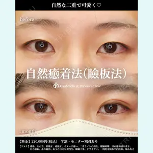 シンデレラ＆ダヴィンチクリニック 宮田 洋佑医師の症例