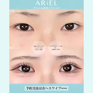 アリエル美容クリニック 大宮院 鈴木　桂介医師の症例