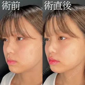 HAAB×DREAM BEAUTY CLINIC 大阪梅田院 柏木 太雅医師の症例