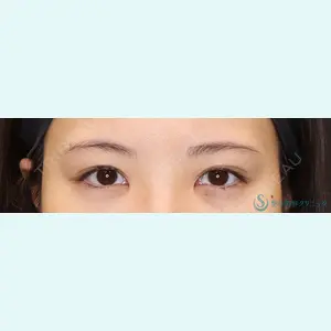 聖心美容クリニック 六本木院 綾部 奈々子医師の症例