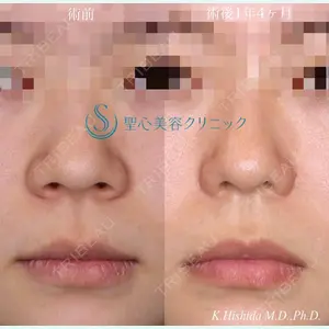 聖心美容クリニック 六本木院 菱田 健作医師の症例