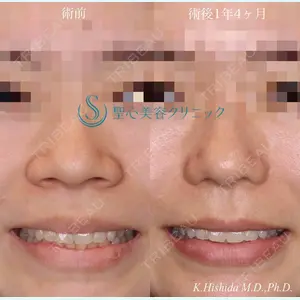 聖心美容クリニック 六本木院 菱田 健作医師の症例