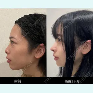 症例