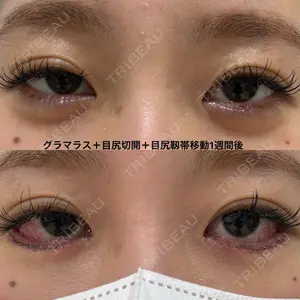 エターナル美容クリニック 久門田 詳医師の症例
