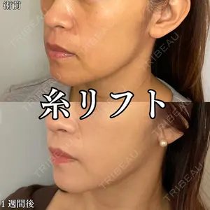 形成外科と美容外科のクリニック池袋 春日 航医師の症例