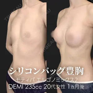 ジョウクリニック 銀座院 重本　譲医師の症例