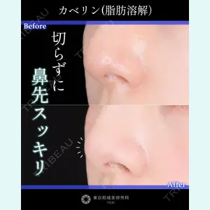 東京形成美容外科 船橋院 山崎 修吾医師の症例