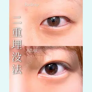 症例