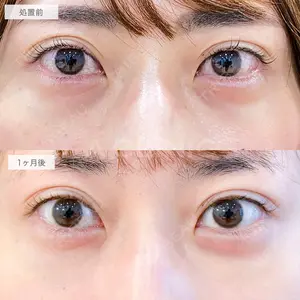 A CLINIC（エークリニック） 仙台院 伊藤 瑠桂医師の症例