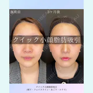 ルラ美容クリニック 札幌院 佐藤 雄紀医師の症例