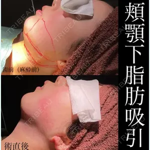 ヴェルトラクリニック 新宿院 伊藤　優医師の症例