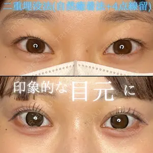 THE FIRST CLINIC 多摩センター院 惟村 公郁医師の症例