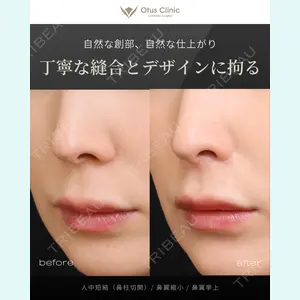 症例