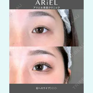 アリエル美容クリニック 郡山院 安齋 誠基医師の症例