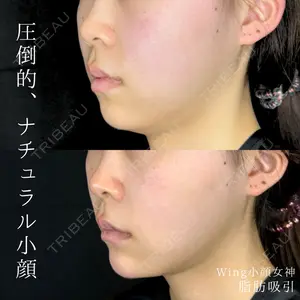 症例