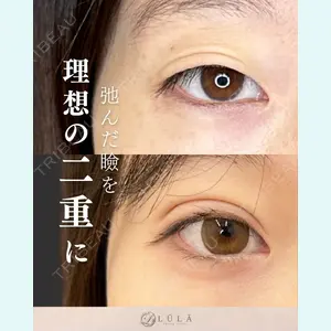 症例