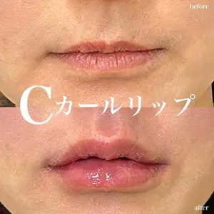 症例