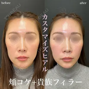 症例