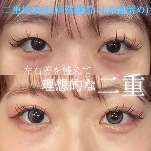 THE FIRST CLINIC 多摩センター院 惟村 公郁医師の症例