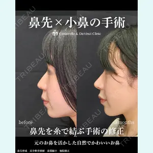 シンデレラ＆ダヴィンチクリニック 宮田 洋佑医師の症例