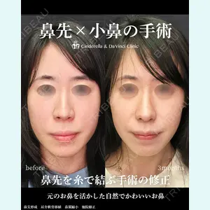 シンデレラ＆ダヴィンチクリニック 宮田 洋佑医師の症例