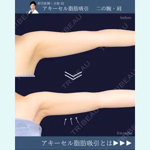 東京シンデレラ美容外科 新宿院 吉原 伯医師の症例