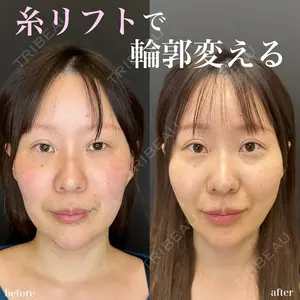 症例