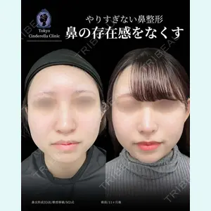 東京シンデレラ美容外科 新宿院 吉原 伯医師の症例