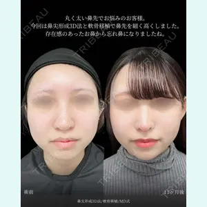 東京シンデレラ美容外科 新宿院 吉原 伯医師の症例
