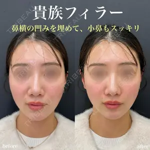 症例