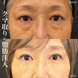 症例