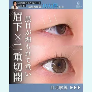 東京シンデレラ美容外科 新宿院 吉原 伯医師の症例