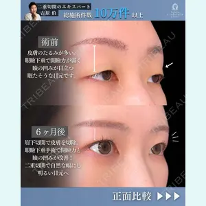東京シンデレラ美容外科 新宿院 吉原 伯医師の症例