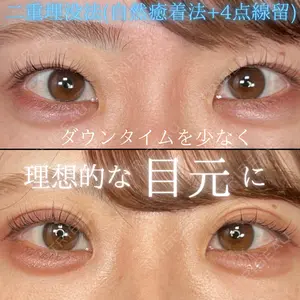 症例