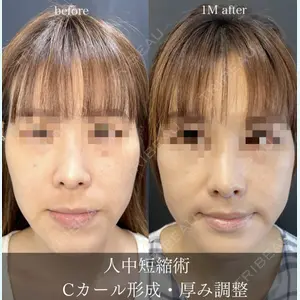 ルラ美容クリニック 岡山院の症例