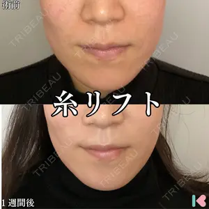 形成外科と美容外科のクリニック池袋 春日 航医師の症例