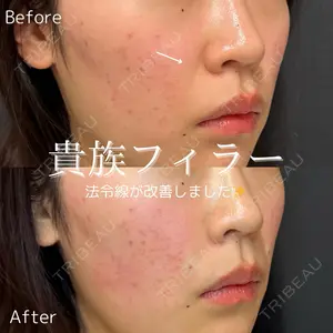 ルラ美容クリニック 仙台院 橋本 英樹医師の症例