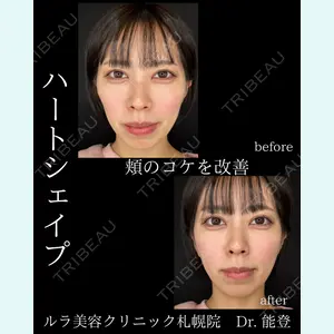 ルラ美容クリニック 札幌院 能登 貴弘医師の症例