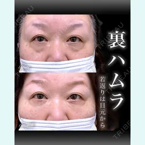 EMMO FACE CLINIC 大宮院 百瀬 直也医師の症例