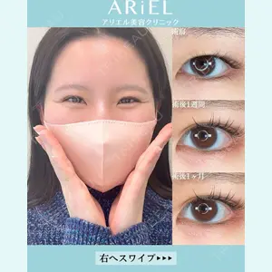 アリエル美容クリニック 大宮院 鈴木　桂介医師の症例