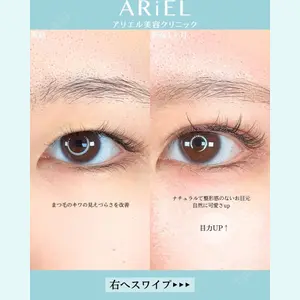 アリエル美容クリニック 大宮院 鈴木　桂介医師の症例