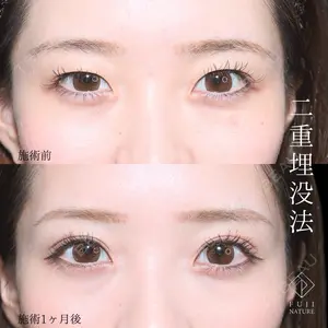 症例