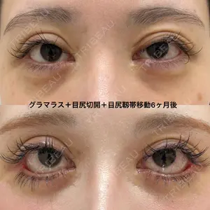 エターナル美容クリニック 久門田 詳医師の症例