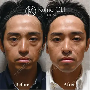 Kuma CLI 【クマクリ】 毛利 理人医師の症例