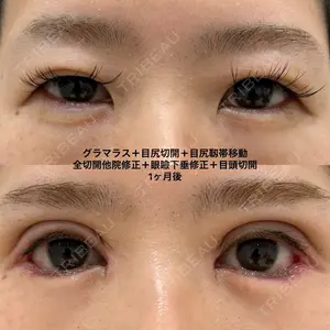 エターナル美容クリニック 久門田 詳医師の症例