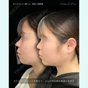 東京シンデレラ美容外科 大宮院 竹田 昌平医師の症例