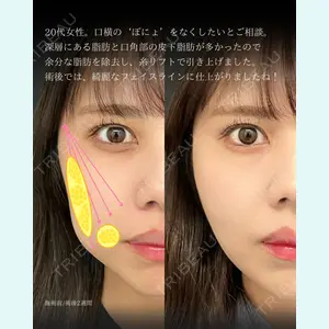 症例