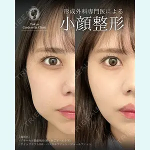 症例